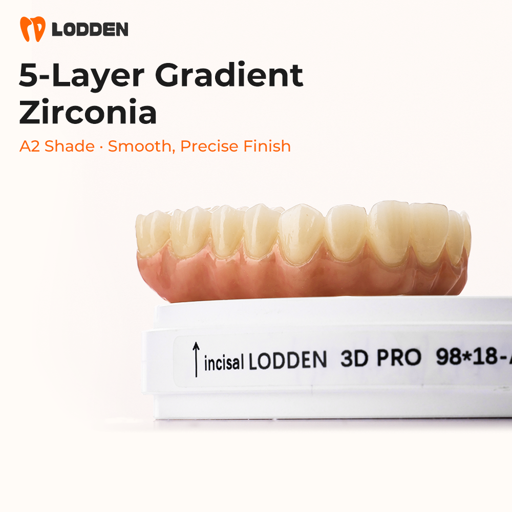 Lodden 3d pro متعدد الطبقات ال - مراجعة 3D Printing Lego وسعره